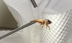 Gắp con gián còn sống khỏi tai người phụ nữ Gắp con gián còn sống khỏi tai người phụ nữ