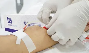 Người bệnh HIV suy thận giai đoạn cuối thoát lọc máu