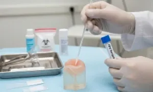 4 lầm tưởng về HPV